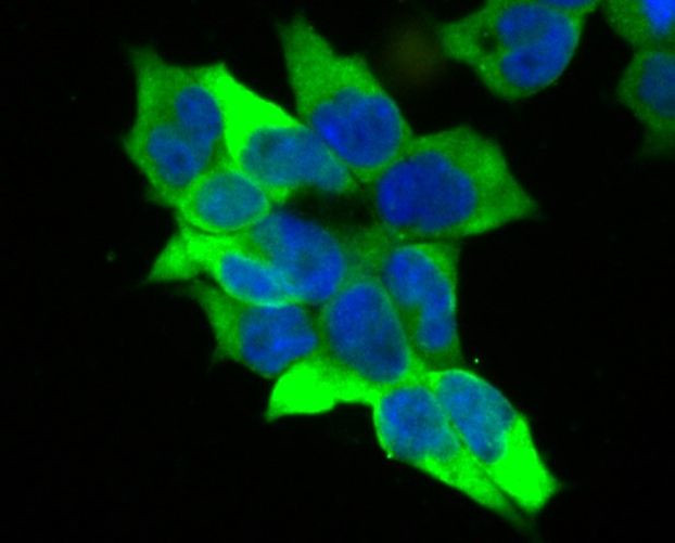 Creatine Kinase MB Antibody in Immunocytochemistry (ICC/IF)