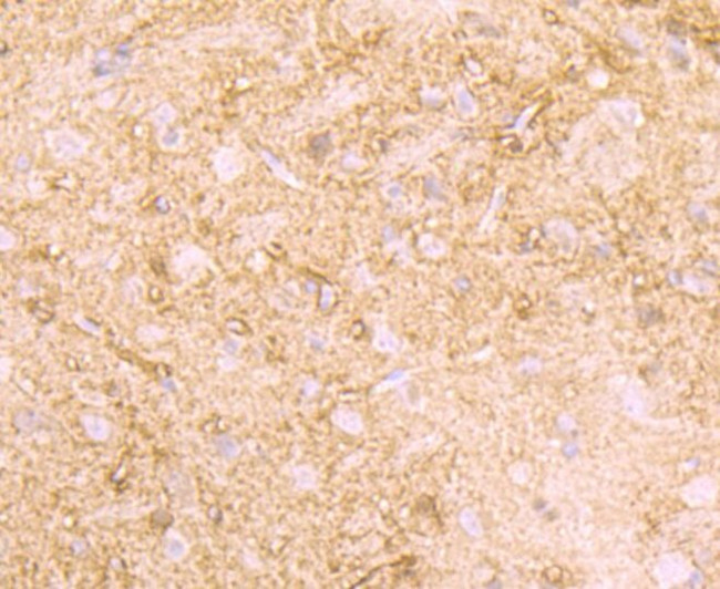 Creatine Kinase MB Antibody in Immunohistochemistry (Paraffin) (IHC (P))