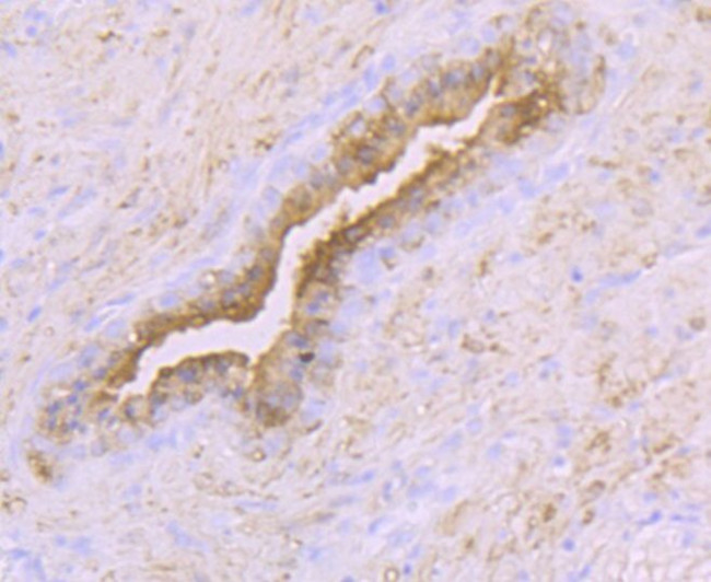 Creatine Kinase MB Antibody in Immunohistochemistry (Paraffin) (IHC (P))