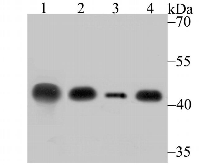 Creatine Kinase MB Antibody in Western Blot (WB)