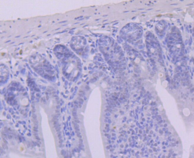 USP7 Antibody in Immunohistochemistry (Paraffin) (IHC (P))