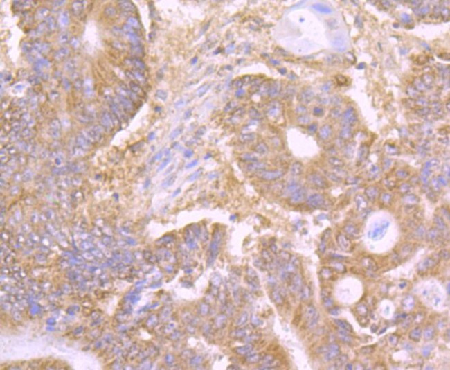 CD205 Antibody in Immunohistochemistry (Paraffin) (IHC (P))