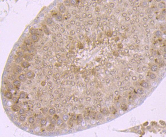 PSMA1 Antibody in Immunohistochemistry (Paraffin) (IHC (P))