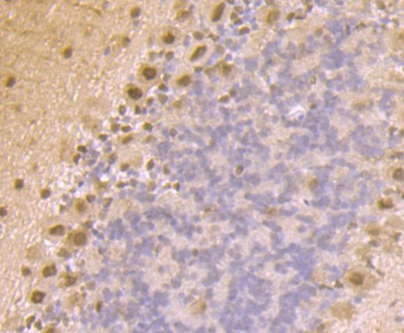 PSMA1 Antibody in Immunohistochemistry (Paraffin) (IHC (P))