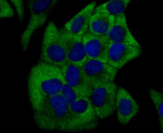 CYP17A1 Antibody in Immunocytochemistry (ICC/IF)