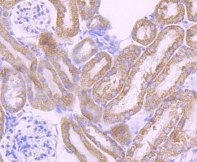 CYP17A1 Antibody in Immunohistochemistry (Paraffin) (IHC (P))