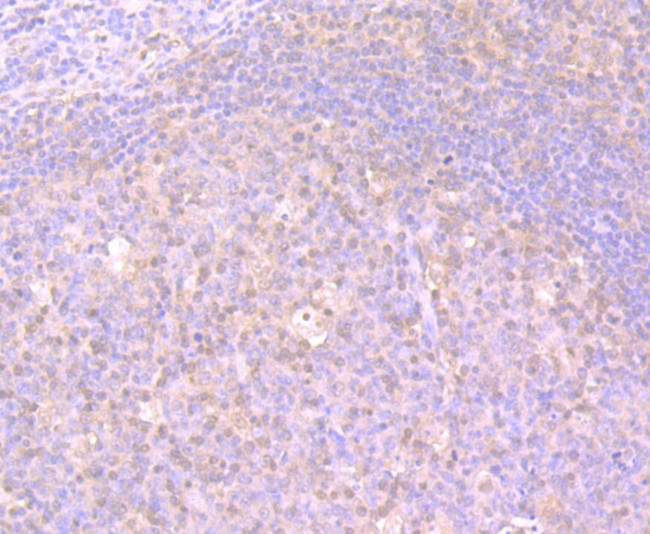 GSS Antibody in Immunohistochemistry (Paraffin) (IHC (P))