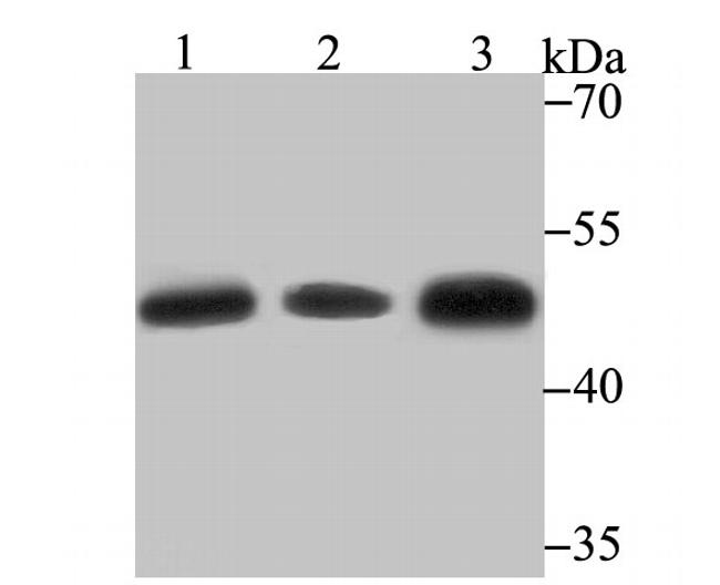 GSS Antibody in Western Blot (WB)