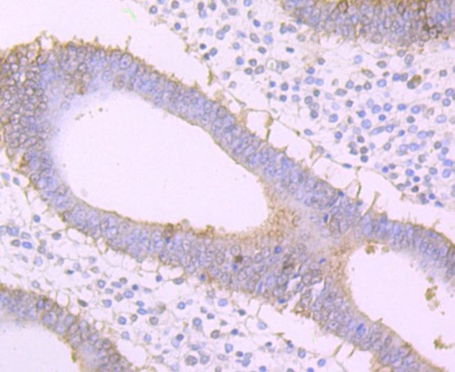 FZD8 Antibody in Immunohistochemistry (Paraffin) (IHC (P))