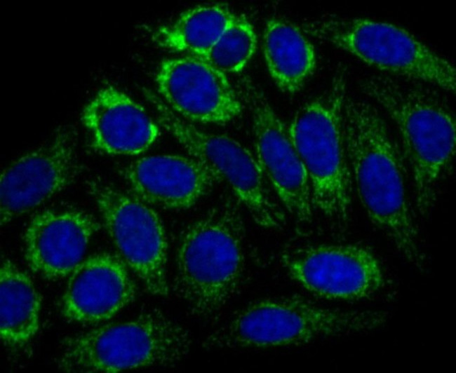 CPS1 Antibody in Immunocytochemistry (ICC/IF)