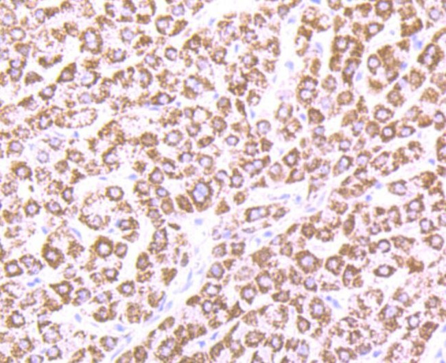 CPS1 Antibody in Immunohistochemistry (Paraffin) (IHC (P))