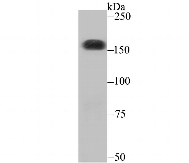 CPS1 Antibody in Western Blot (WB)