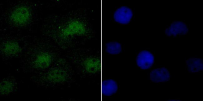 SRSF1 Antibody in Immunocytochemistry (ICC/IF)