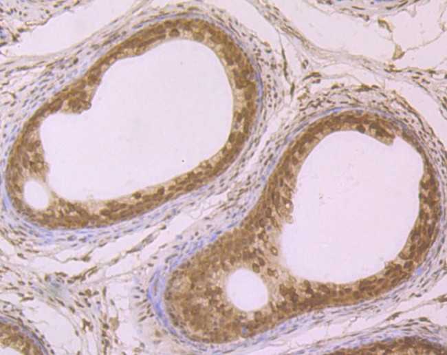 SRSF1 Antibody in Immunohistochemistry (Paraffin) (IHC (P))