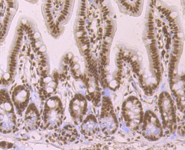 SRSF1 Antibody in Immunohistochemistry (Paraffin) (IHC (P))