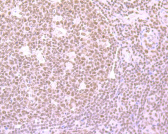 SRSF1 Antibody in Immunohistochemistry (Paraffin) (IHC (P))