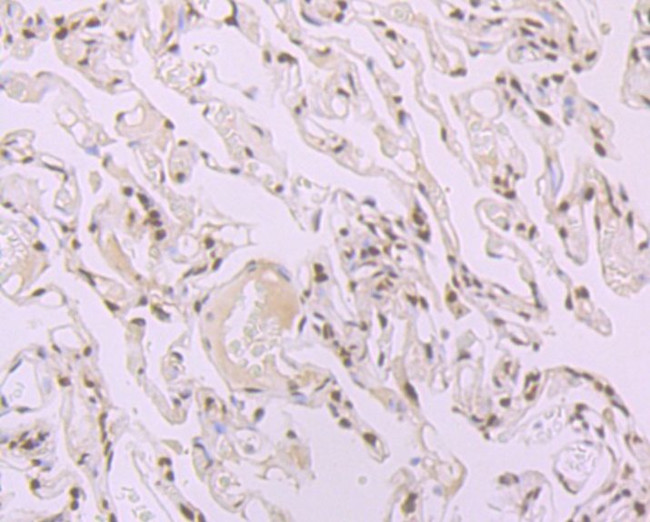 SRSF1 Antibody in Immunohistochemistry (Paraffin) (IHC (P))