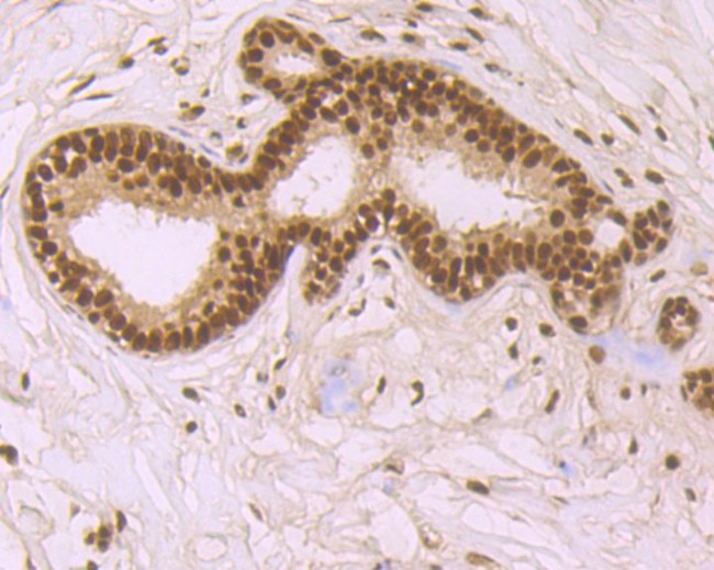 SRSF1 Antibody in Immunohistochemistry (Paraffin) (IHC (P))