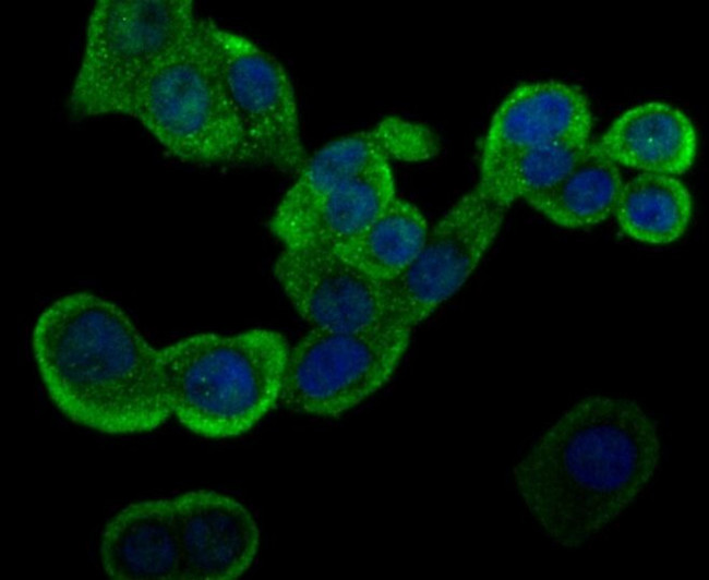 GSTP1 Antibody in Immunocytochemistry (ICC/IF)