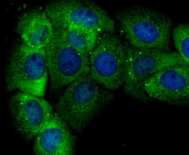 GSTP1 Antibody in Immunocytochemistry (ICC/IF)