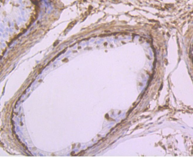 GSTP1 Antibody in Immunohistochemistry (Paraffin) (IHC (P))