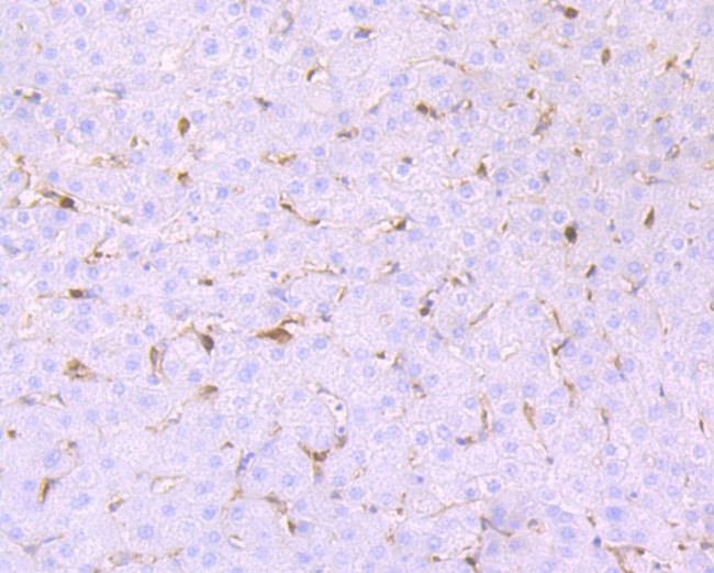 GSTP1 Antibody in Immunohistochemistry (Paraffin) (IHC (P))