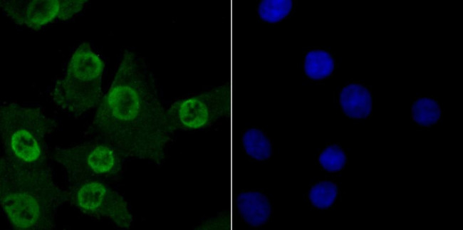 MBD3 Antibody in Immunocytochemistry (ICC/IF)