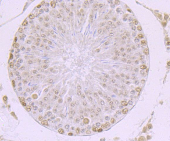 MBD3 Antibody in Immunohistochemistry (Paraffin) (IHC (P))