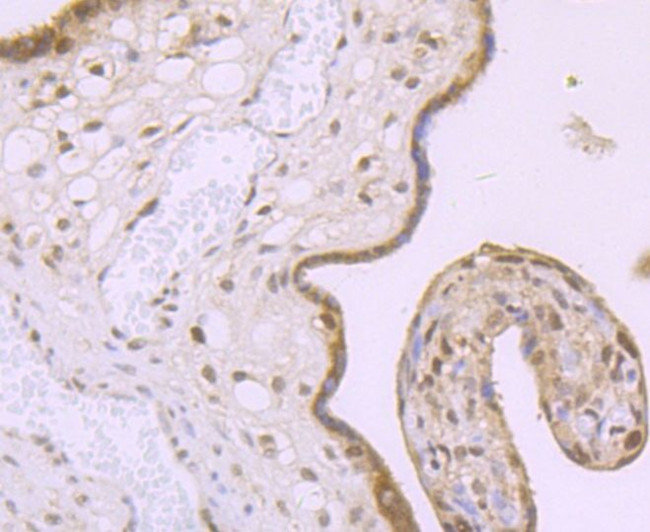 MBD3 Antibody in Immunohistochemistry (Paraffin) (IHC (P))