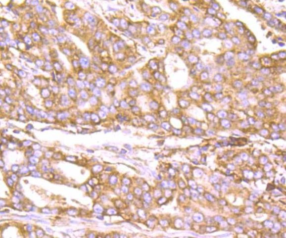 KDEL Antibody in Immunohistochemistry (Paraffin) (IHC (P))