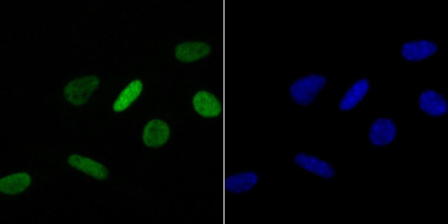 H4K16ac Antibody in Immunocytochemistry (ICC/IF)