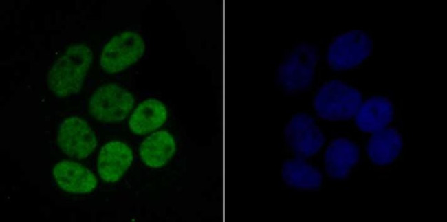 H4K16ac Antibody in Immunocytochemistry (ICC/IF)