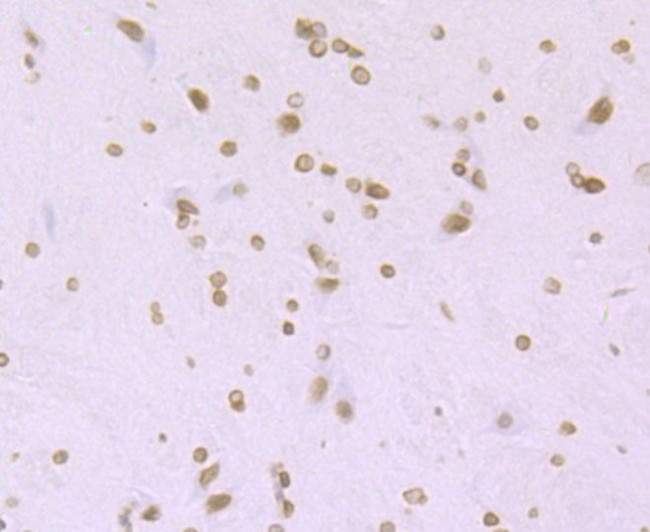 H4K16ac Antibody in Immunohistochemistry (Paraffin) (IHC (P))