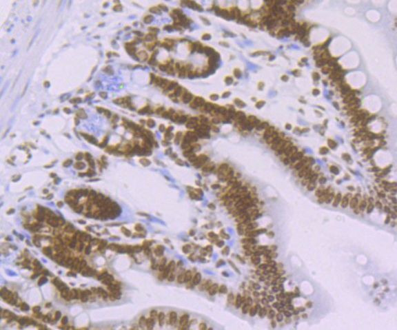 H4K16ac Antibody in Immunohistochemistry (Paraffin) (IHC (P))