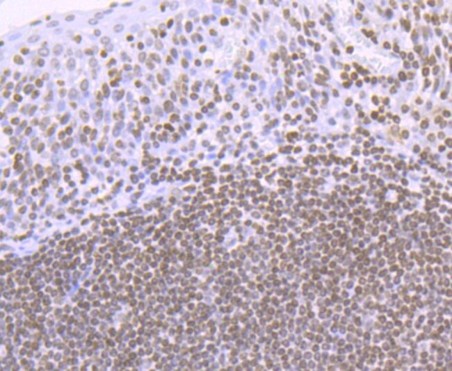 H4K16ac Antibody in Immunohistochemistry (Paraffin) (IHC (P))