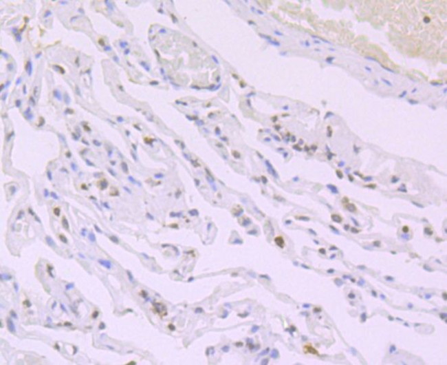 H4K16ac Antibody in Immunohistochemistry (Paraffin) (IHC (P))