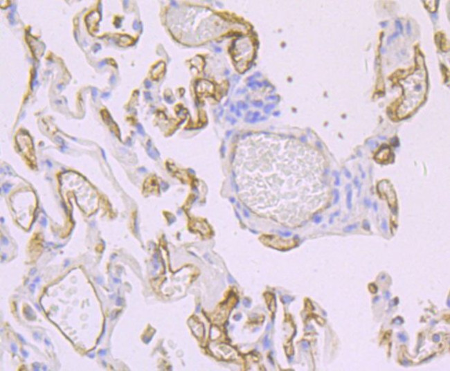 Thrombomodulin Antibody in Immunohistochemistry (Paraffin) (IHC (P))