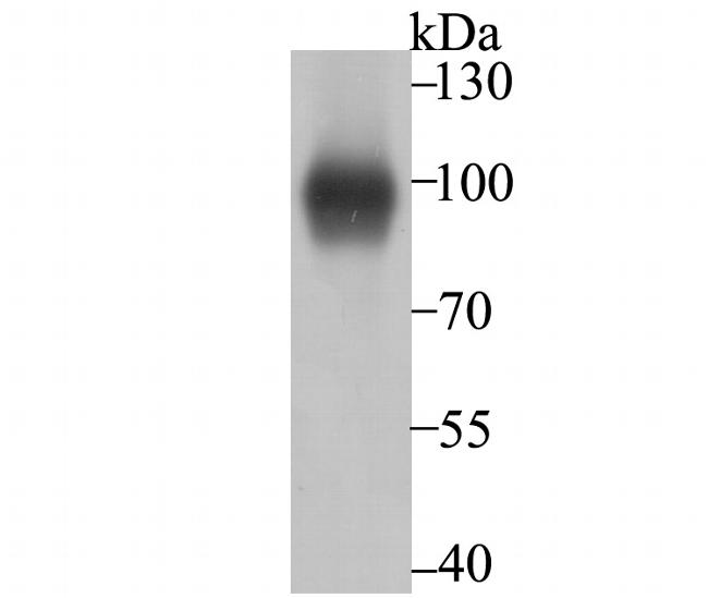 Thrombomodulin Antibody in Western Blot (WB)