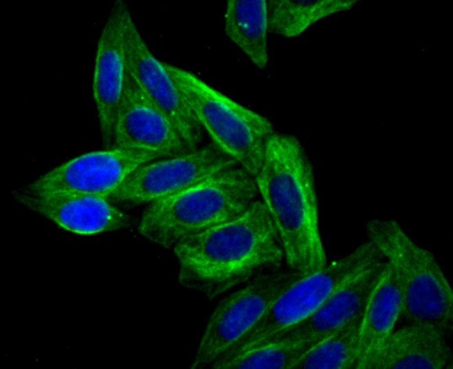 Arp3 Antibody in Immunocytochemistry (ICC/IF)