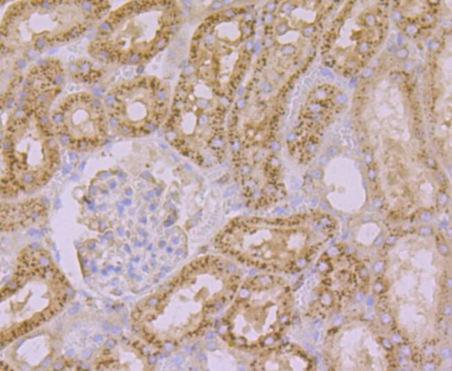 Arp3 Antibody in Immunohistochemistry (Paraffin) (IHC (P))