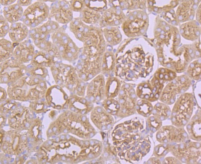 Arp3 Antibody in Immunohistochemistry (Paraffin) (IHC (P))