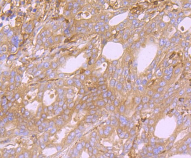 Arp3 Antibody in Immunohistochemistry (Paraffin) (IHC (P))