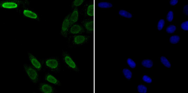 SNRPA Antibody in Immunocytochemistry (ICC/IF)