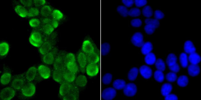 SNRPA Antibody in Immunocytochemistry (ICC/IF)