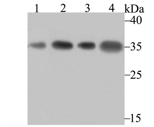 SNRPA Antibody in Western Blot (WB)