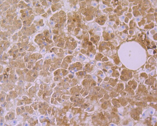 CYP26A1 Antibody in Immunohistochemistry (Paraffin) (IHC (P))