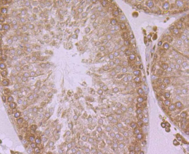 ERP29 Antibody in Immunohistochemistry (Paraffin) (IHC (P))