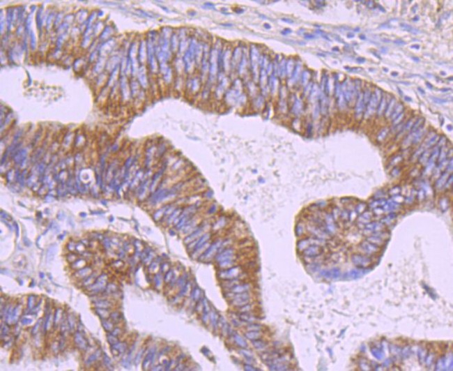 ERP29 Antibody in Immunohistochemistry (Paraffin) (IHC (P))