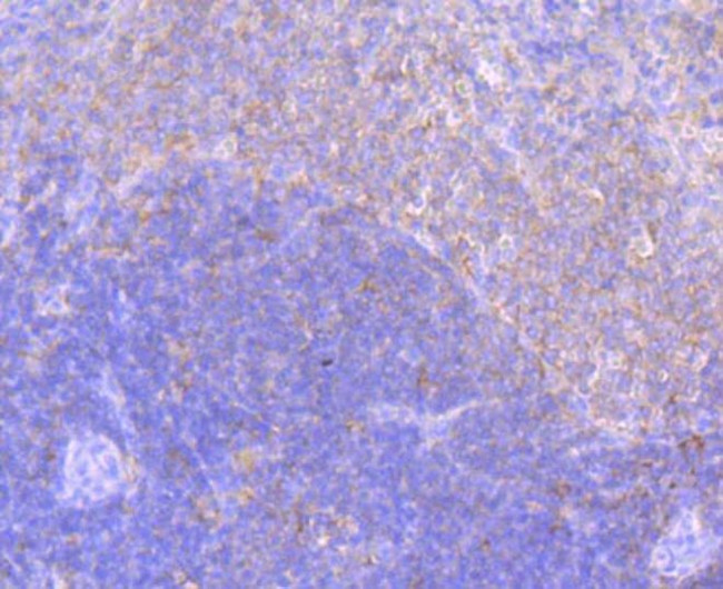 ELMO1 Antibody in Immunohistochemistry (Paraffin) (IHC (P))