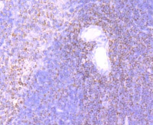 ELMO1 Antibody in Immunohistochemistry (Paraffin) (IHC (P))